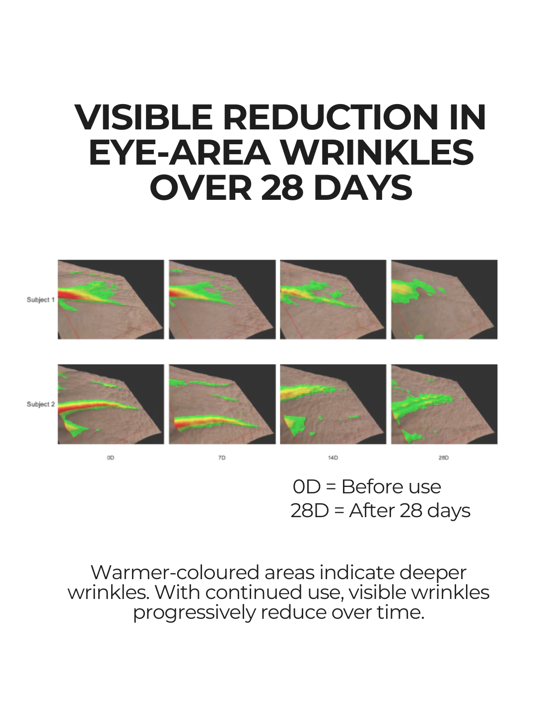 Clinical skin imaging showing visible reduction in eye-area wrinkles over 28 days using 28N A⁶