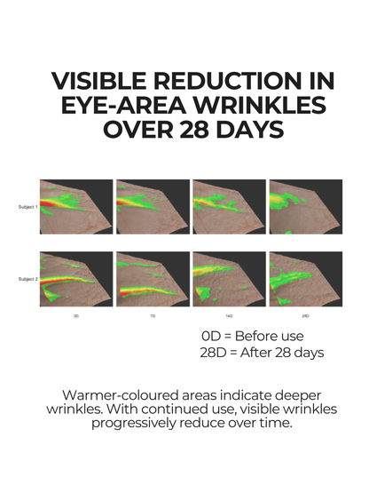 Clinical skin imaging showing visible reduction in eye-area wrinkles over 28 days using 28N A⁶