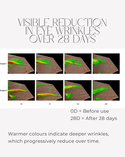 Clinical skin imaging showing visible reduction in eye wrinkles after 28 days using 28N A⁶