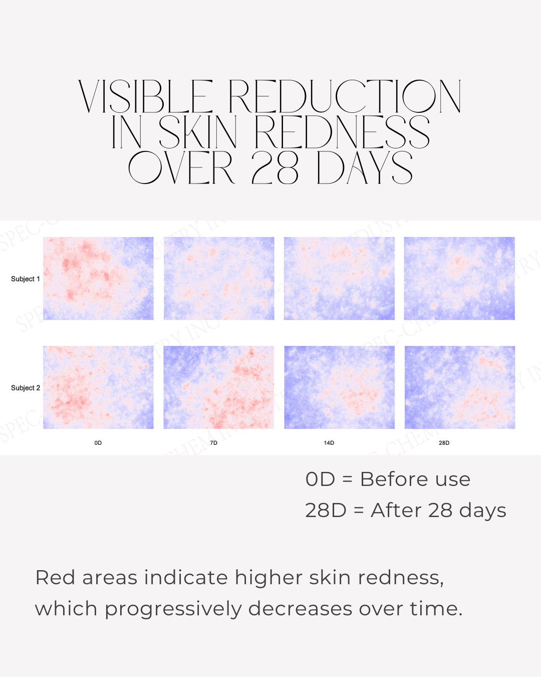Clinical skin imaging showing reduction in visible skin redness after 28 days using 28N A⁶