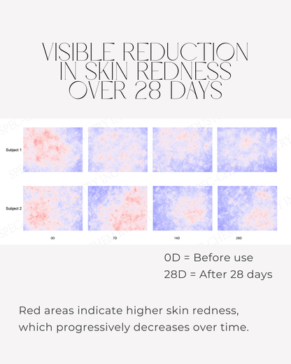 Clinical skin imaging showing reduction in visible skin redness after 28 days using 28N A⁶