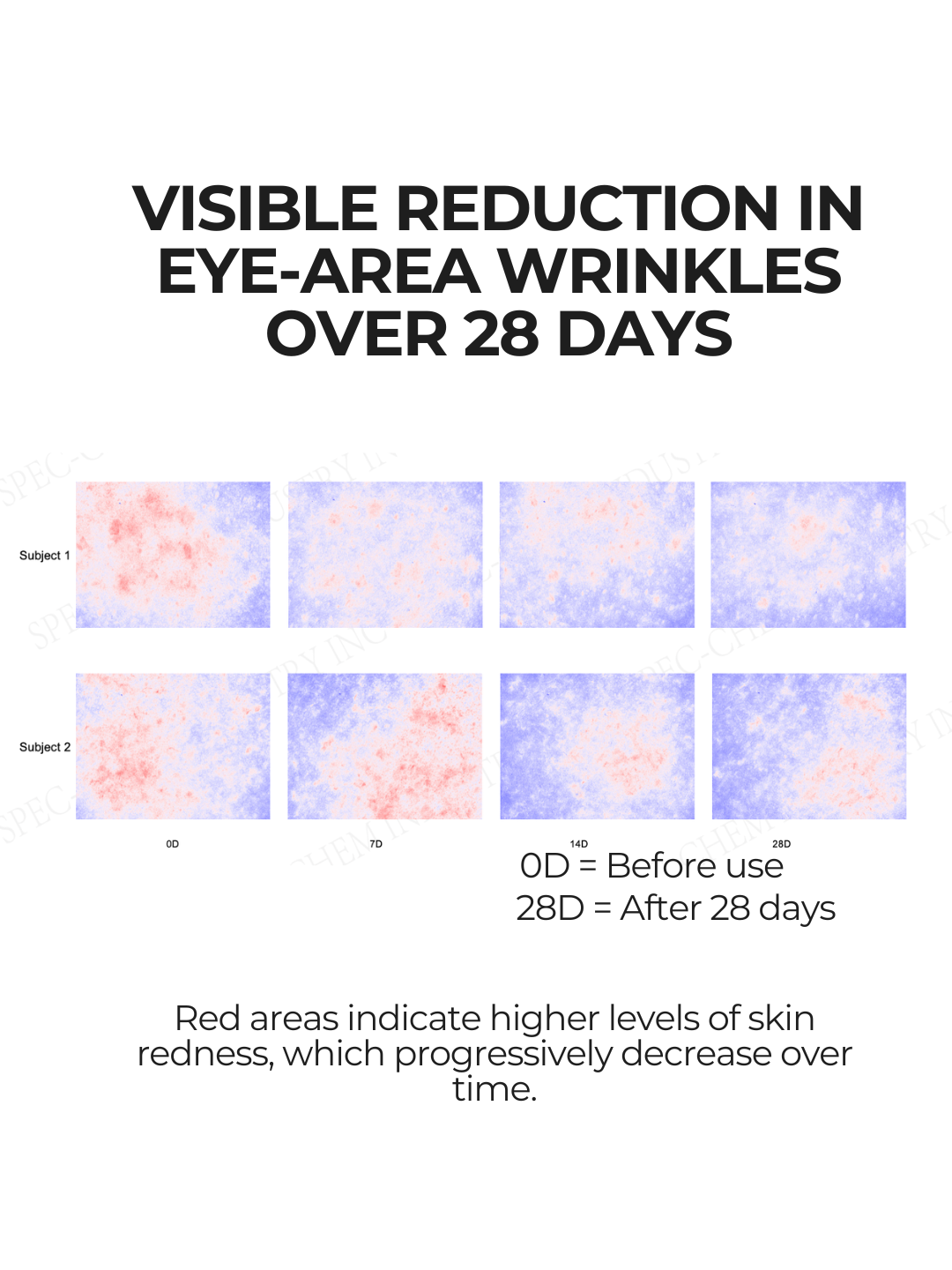 Clinical skin imaging showing reduced visible skin redness over 28 days using 28N A⁶