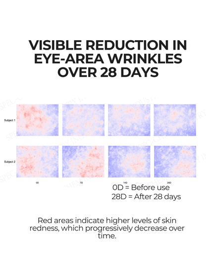 Clinical skin imaging showing reduced visible skin redness over 28 days using 28N A⁶