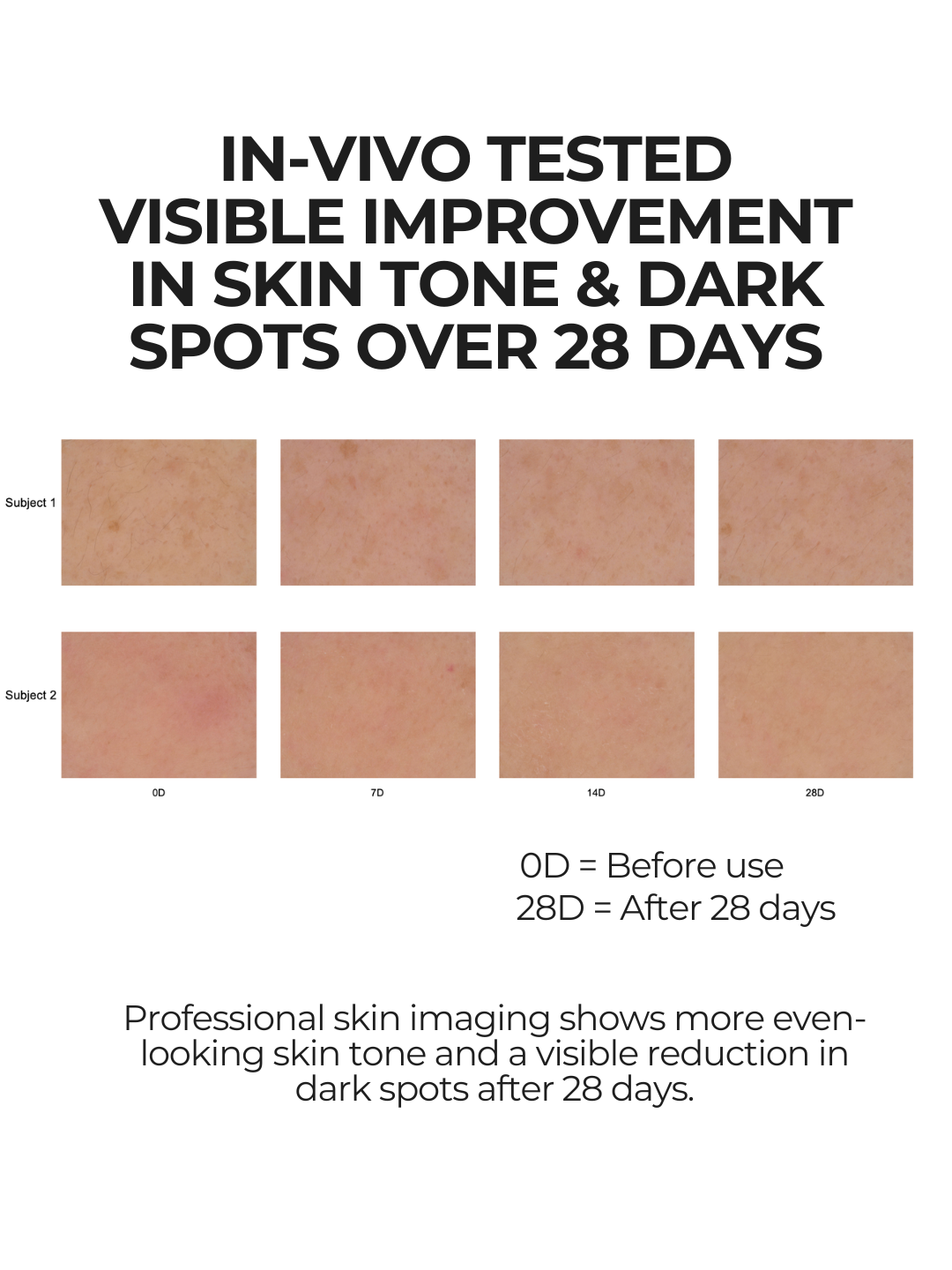 Professional skin imaging showing more even-looking skin tone and reduced visible dark spots after 28 days using 28N B⁶
