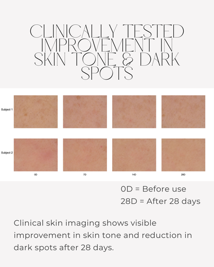 Clinical skin imaging showing improved skin tone and reduced visible dark spots after 28 days using 28N B⁶