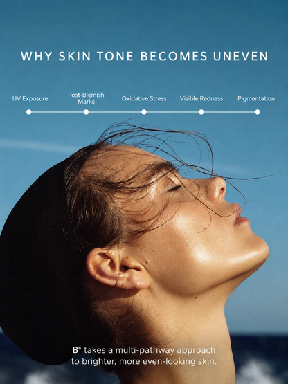 Causes of uneven skin tone including UV exposure, post-blemish marks, oxidative stress, redness and pigmentation
