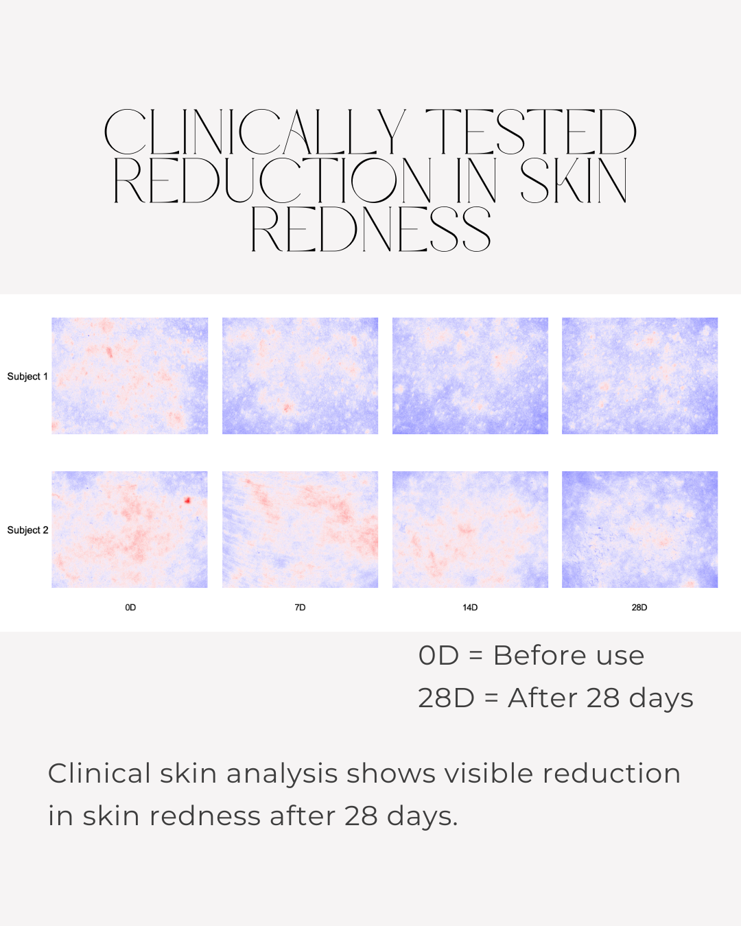 Clinical skin imaging showing reduction in visible redness after 28 days using 28N B⁶ Brightening Formula
